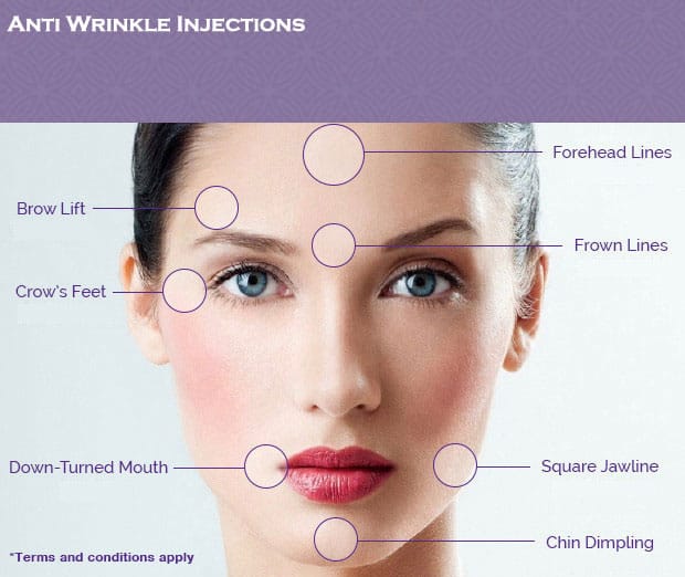 Cosmetic Injections Sydney